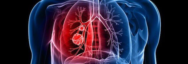 سیلیس کریستالی